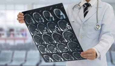 JSST tomonidan meningitni tashxislash va davolash bo‘yicha yo‘riqnoma e’lon qilindi